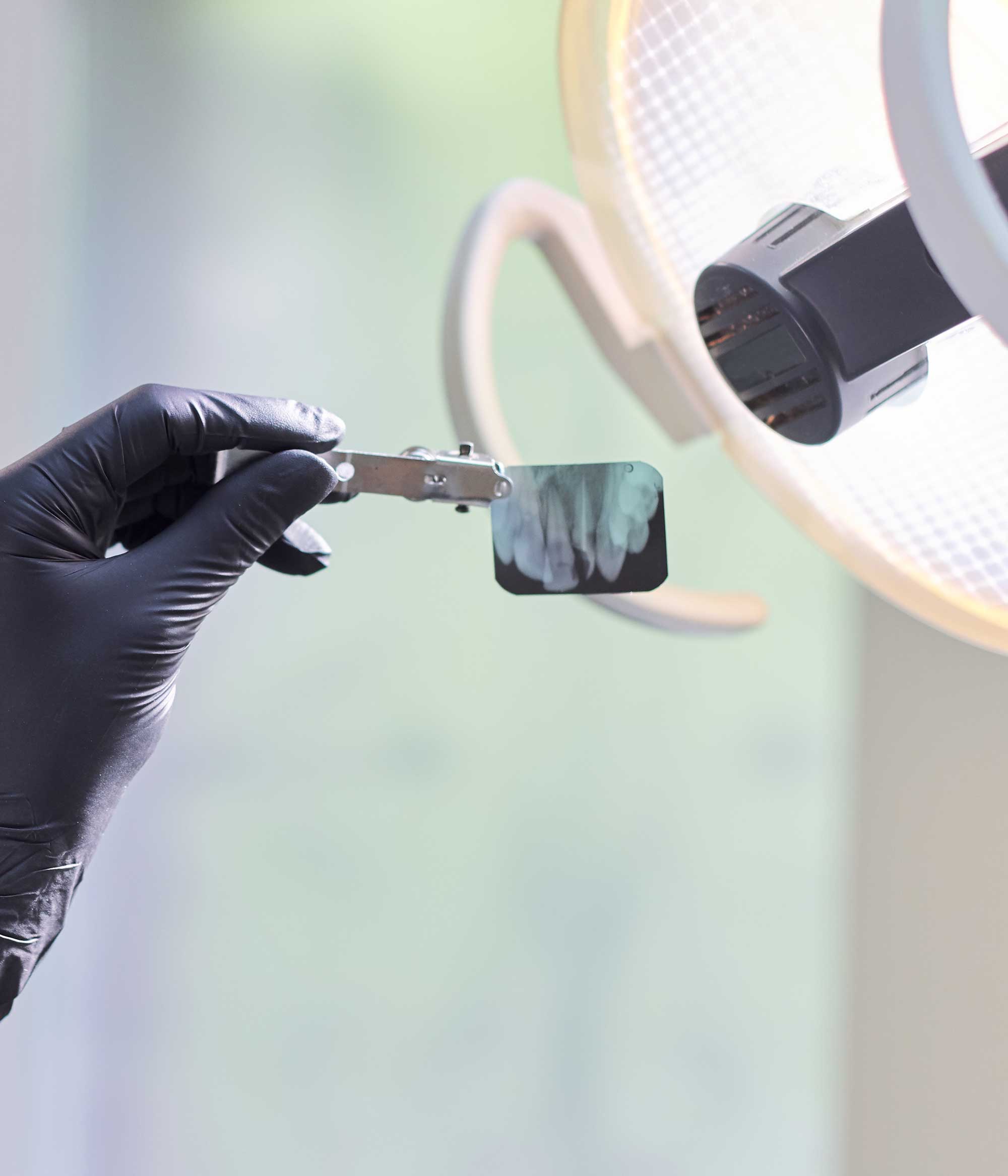 clínica dental en Aluche, dentista en Aluche, cirugía oral en Aluche.