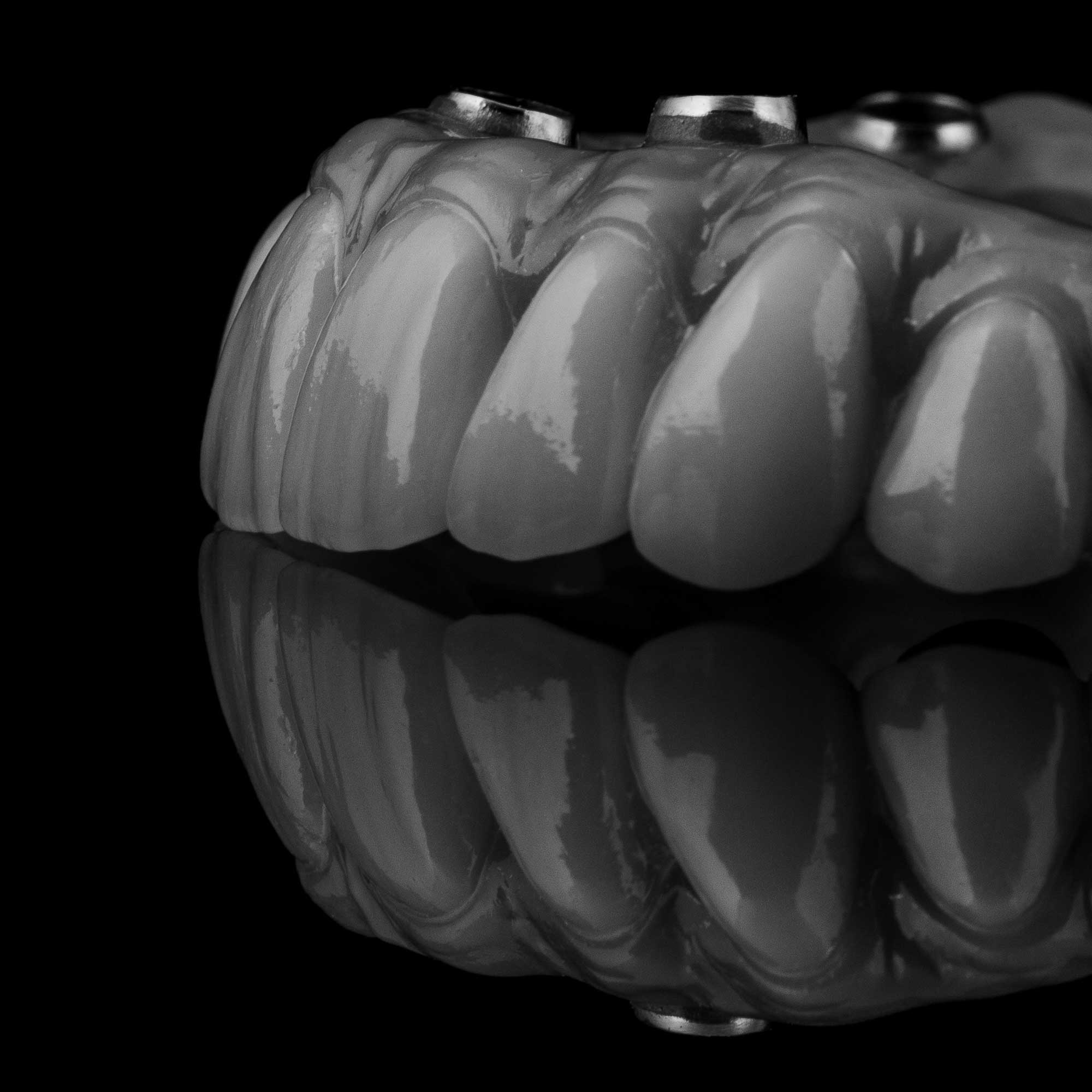 clínica dental en Aluche, dentista en Aluche, implantes dentales en Aluche, implantes dentales en dos fases en Aluche, implantes dentales de carga inmediata en Aluche, implantes dentales all on four en Aluche.