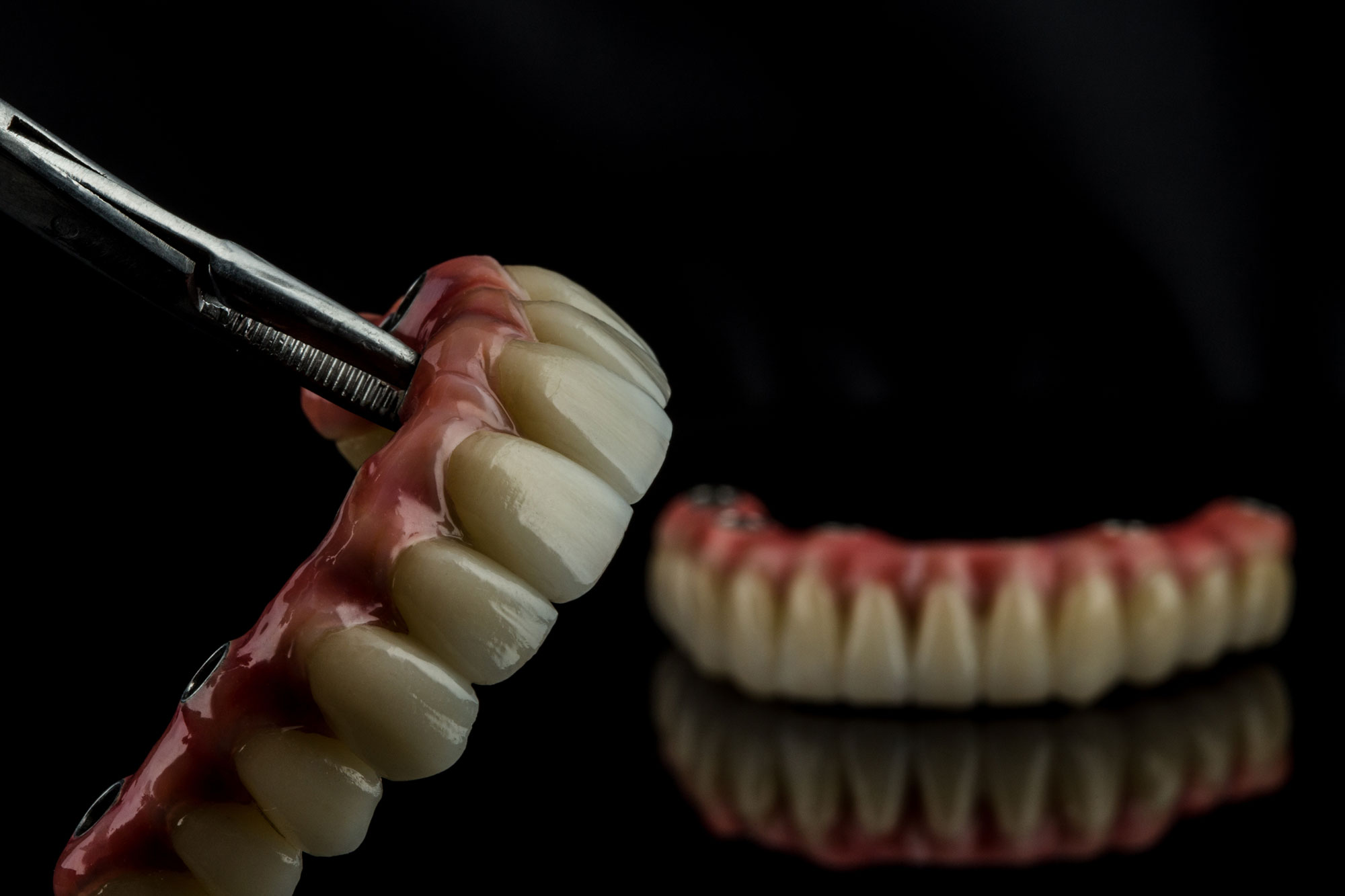 clínica dental en Aluche, dentista en Aluche, implantes dentales en Aluche, implantes dentales en dos fases en Aluche, implantes dentales de carga inmediata en Aluche, implantes dentales all on four en Aluche.