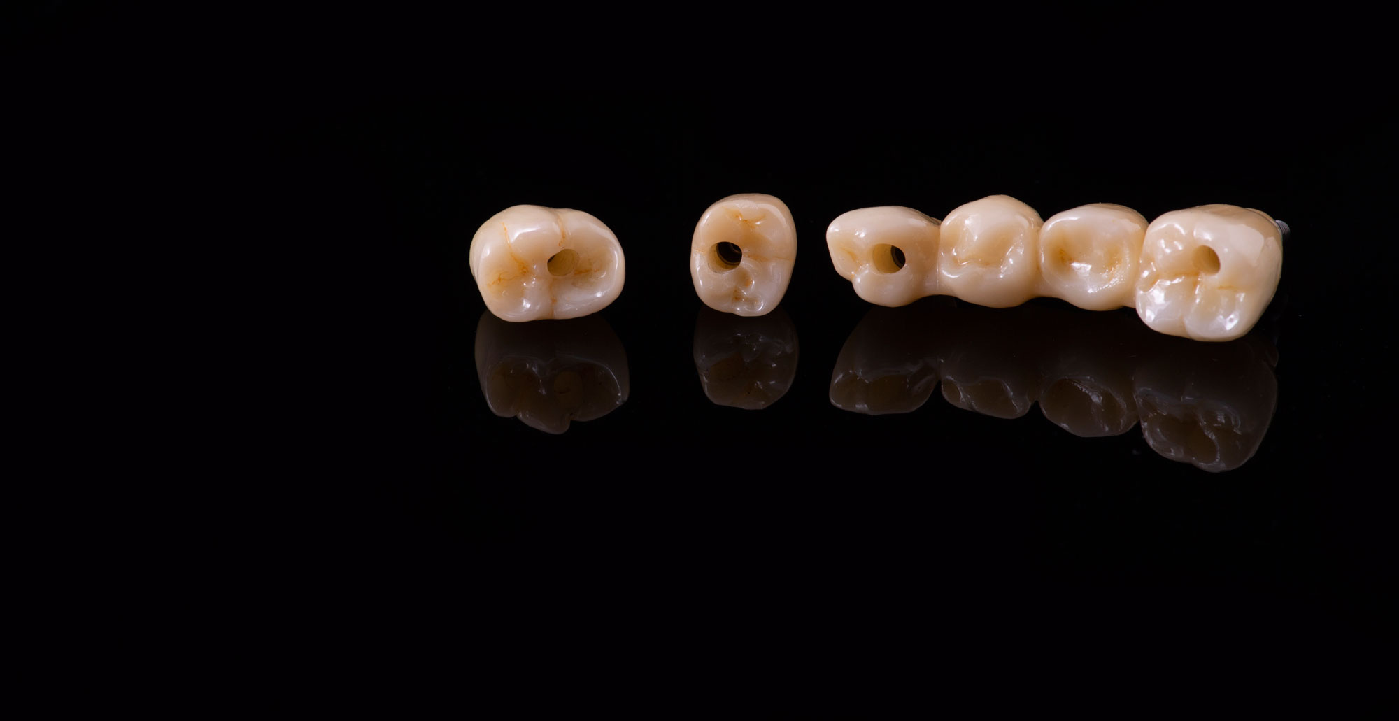 clínica dental en Aluche, dentista en Aluche, implantes dentales en Aluche, implantes dentales en dos fases en Aluche, implantes dentales de carga inmediata en Aluche, implantes dentales all on four en Aluche.